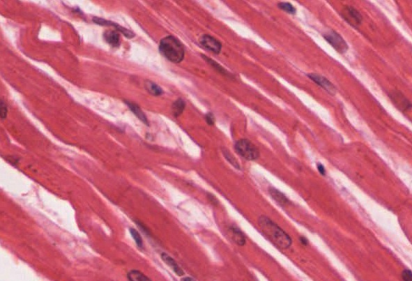 cardiac muscle cells