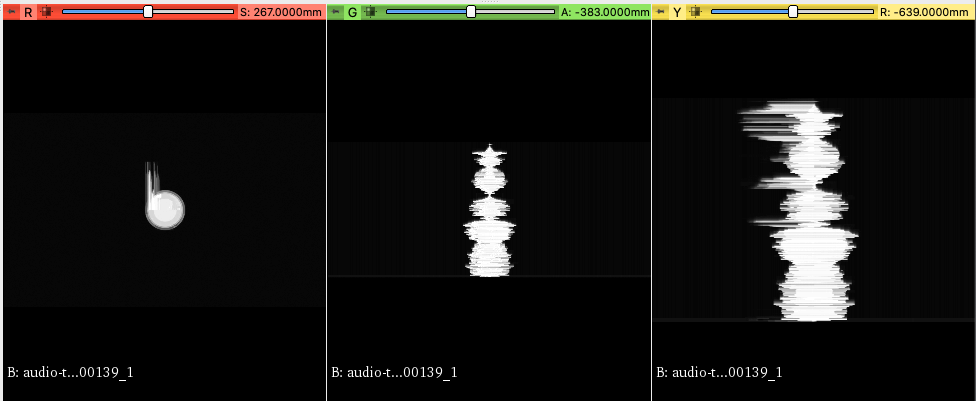 3D slicer interface